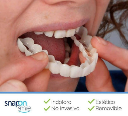 Carillas Dentales Snap On Smile®