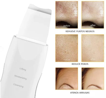 Cleanlifting™  Facial