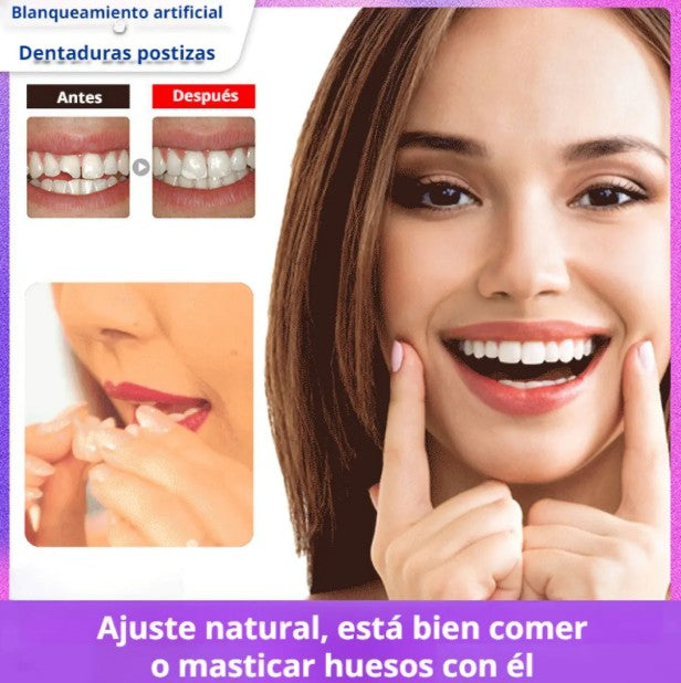 Carillas Dentales Snap On Smile®